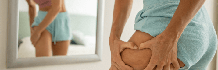Ritenzione idrica addio: Omega‑3, idratazione & movimento - Nutrimaris